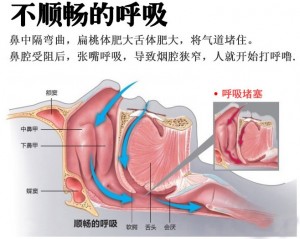 呼吸机出租为何能发展的比较好